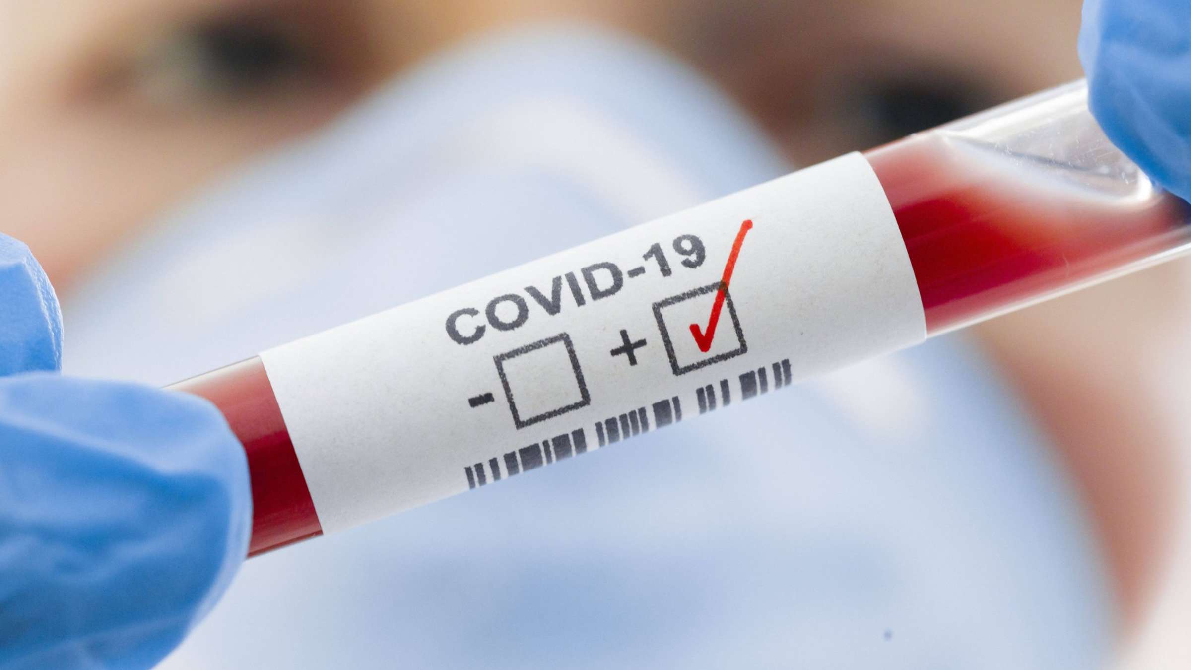 По состоянию на 16 апреля в Беларуси проведено более 81 тысячи тестов на коронавирусную инфекцию.